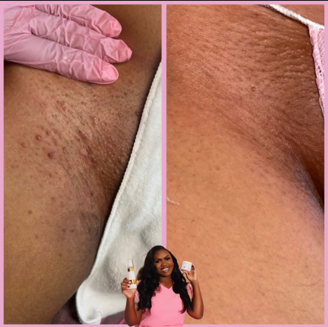 ByeBye Bump Exfoliating Pads