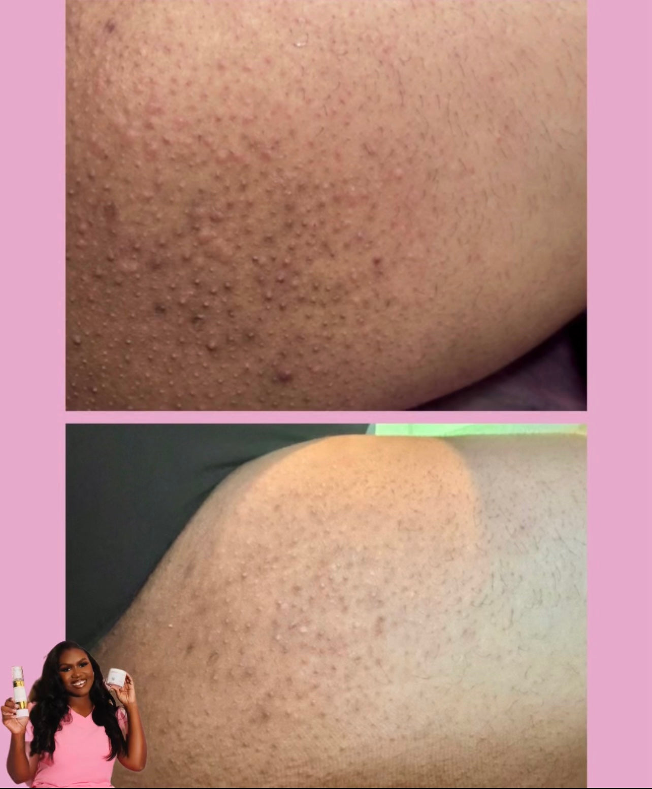 ByeBye Bump Exfoliating Pads